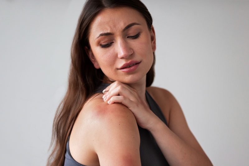 Rash After Sun Exposure? It Could Be a Sun Allergy Rash After Sun Exposure? It Could Be a Sun Allergy