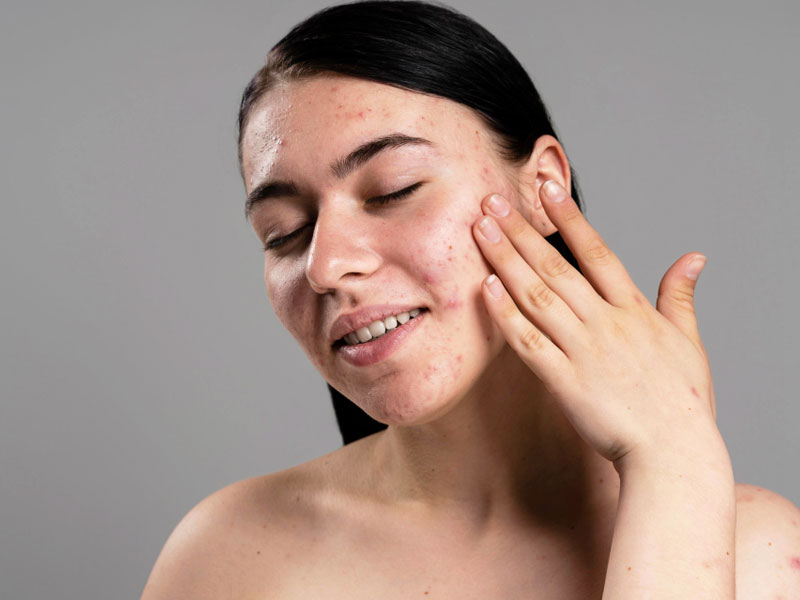 Winter Skin Worries: Common Problems and Proactive Solutions Winter Skin Worries: Common Problems and Proactive Solutions