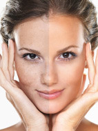 Skin Specialist in Indirapuram